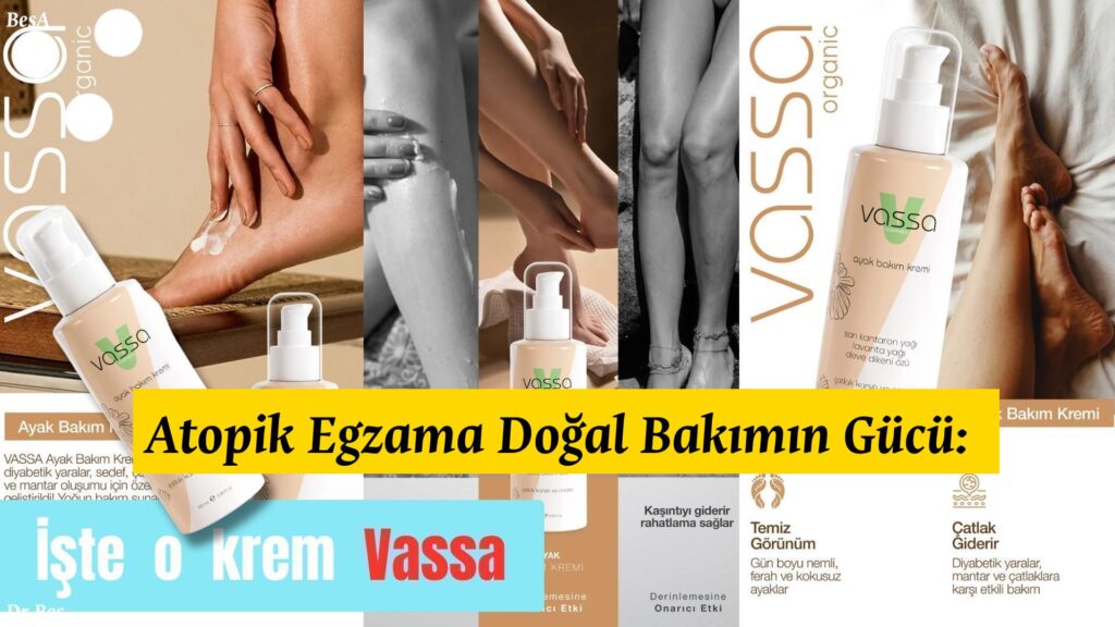 atopik-egzama - krem Atopik Egzama Doğal Bakımın Gücü: Cildine Şifa için alternatif metin