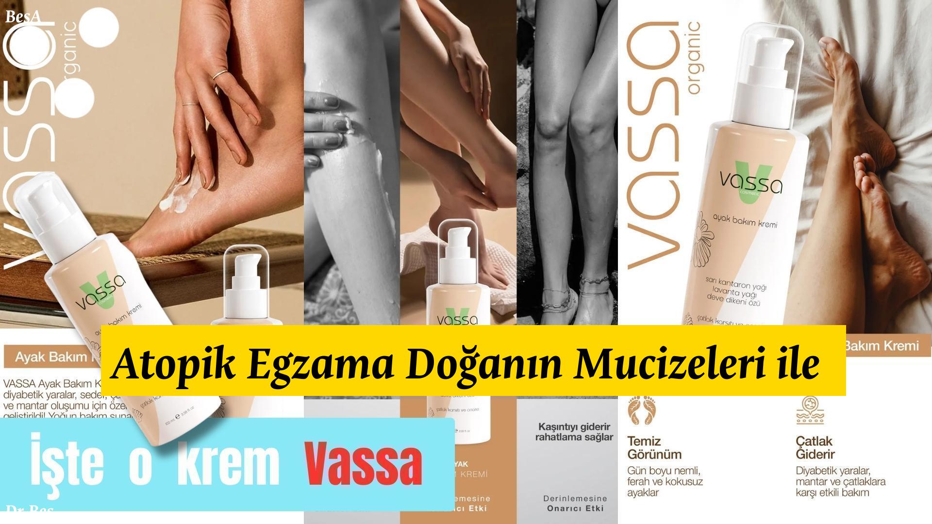 atopik-egzama - krem Atopik Egzama Doğanın Mucizeleri ile Cildinizi Yenileyin için alternatif metin