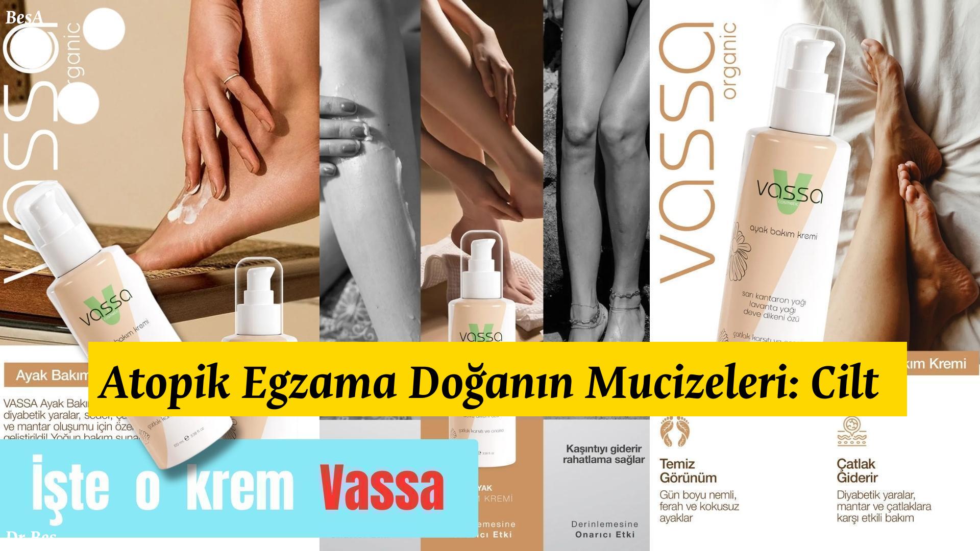 atopik-egzama - krem Atopik Egzama Doğanın Mucizeleri: Cilt Bakımı! için alternatif metin