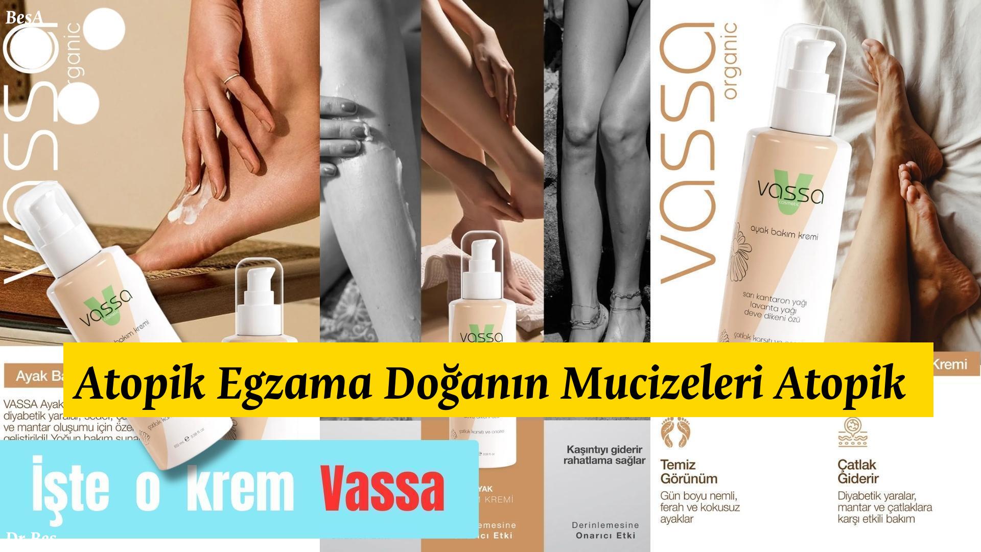 atopik-egzama - krem Atopik Egzama Doğanın Mucizeleri Atopik Egzama İçin için alternatif metin