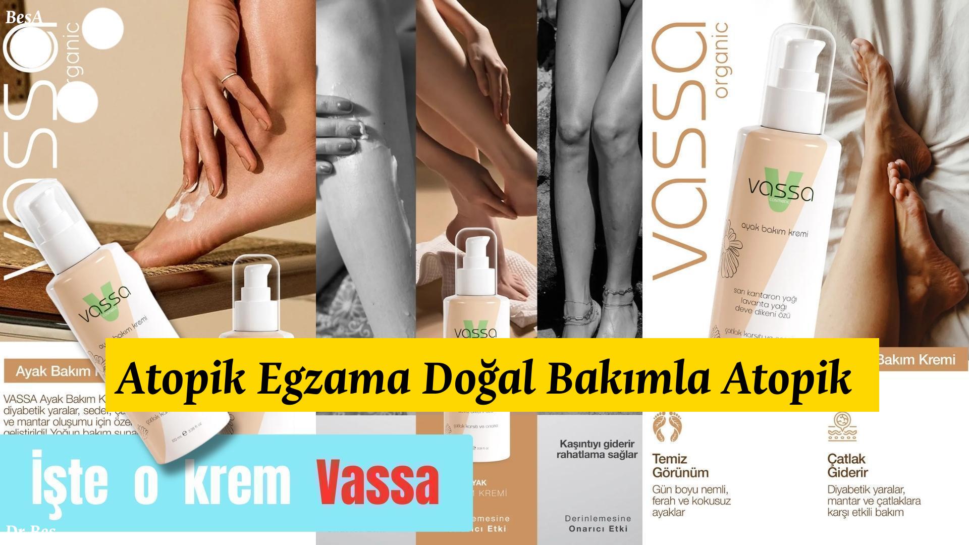atopik-egzama - krem Atopik Egzama Doğal Bakımla Atopik Egzama'ya Veda! için alternatif metin