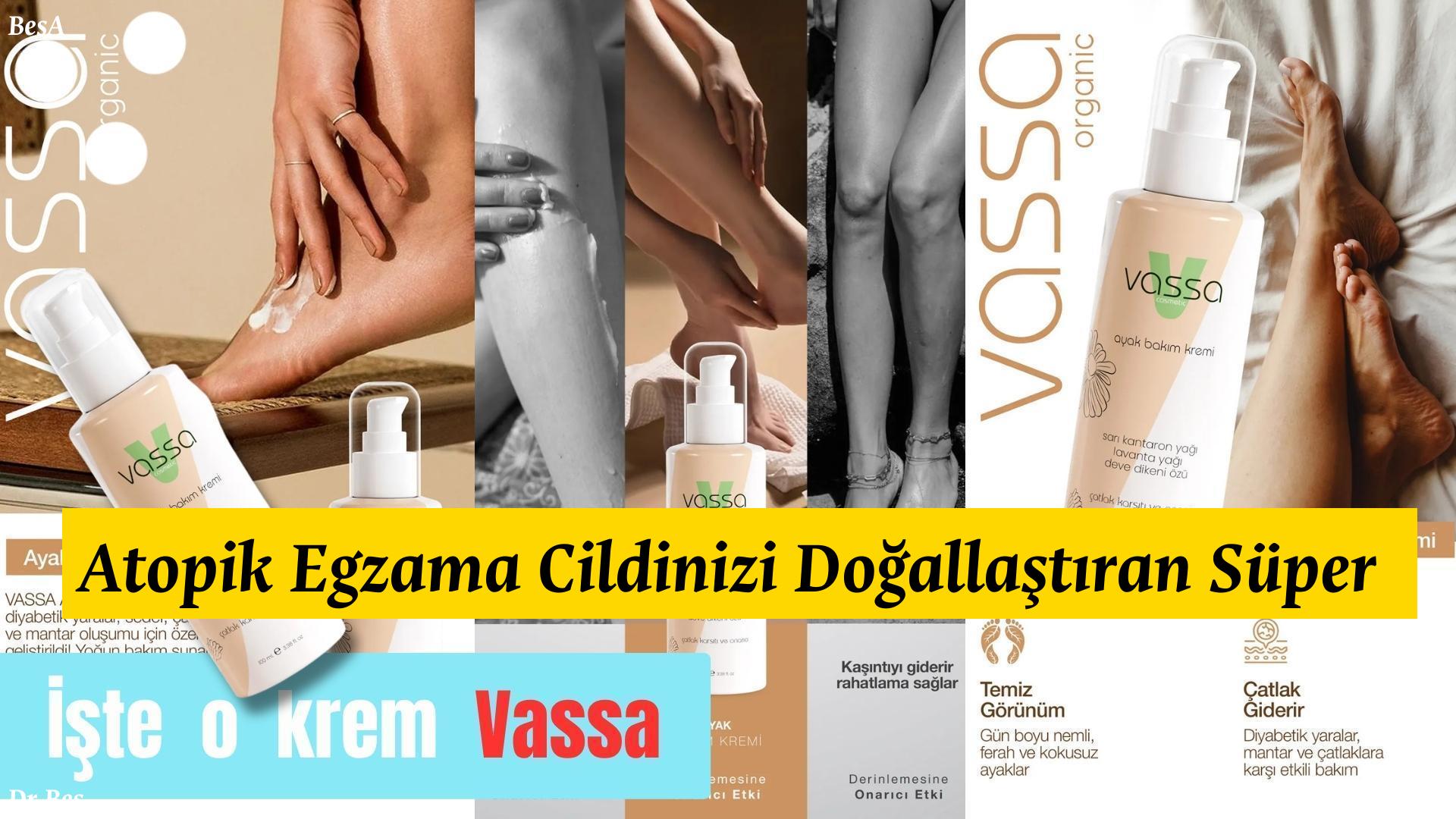atopik-egzama - krem Atopik Egzama Cildinizi Doğallaştıran Süper Kahramanlar! için alternatif metin