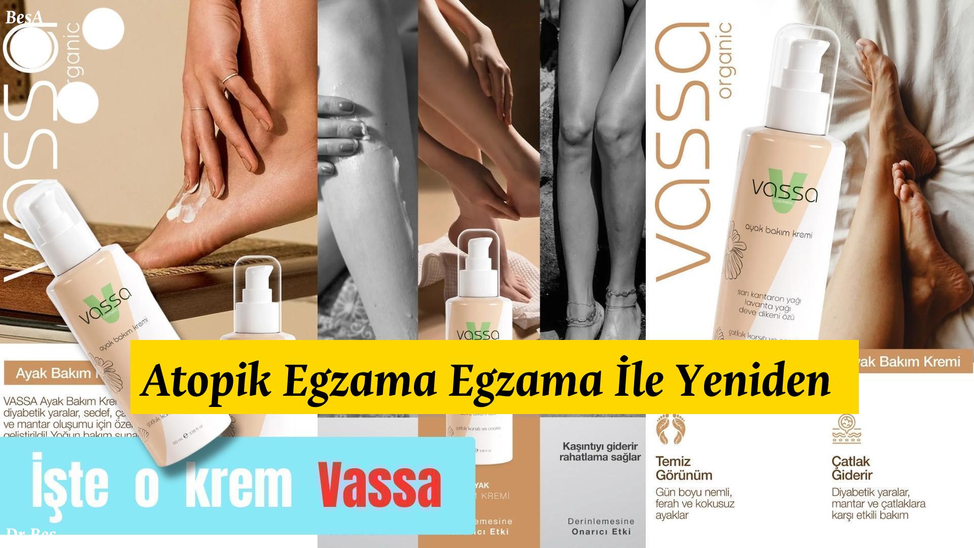 atopik-egzama - krem Atopik Egzama Egzama İle Yeniden Doğuş! için alternatif metin